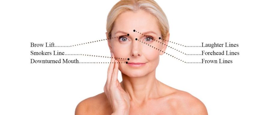 anti wrinkle injections at Chelmsford's best aesthetics salon